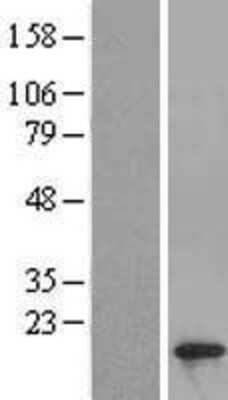 Western Blot: SIVA Overexpression Lysate [NBL1-15981]