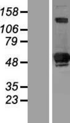 Western Blot: SIVA Overexpression Lysate [NBP2-10413]