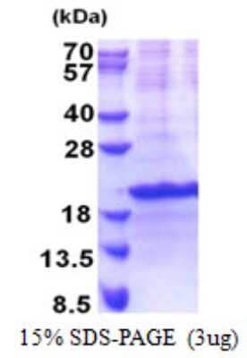 SDS-PAGE: Recombinant Human SIVA His Protein [NBP2-22808]