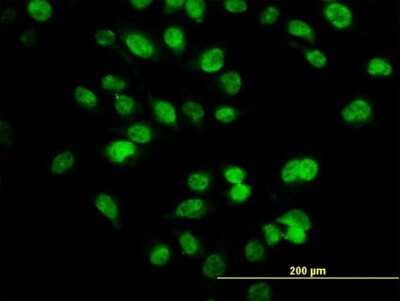 Immunocytochemistry/ Immunofluorescence: SIX4 Antibody (7E2) [H00051804-M09]