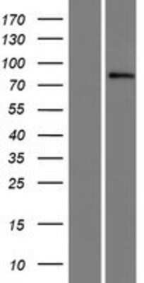 Western Blot: SIX4 Overexpression Lysate [NBP2-06982]