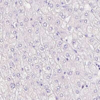Immunohistochemistry-Paraffin: SIX1 Antibody (CL0185) [NBP2-52873]