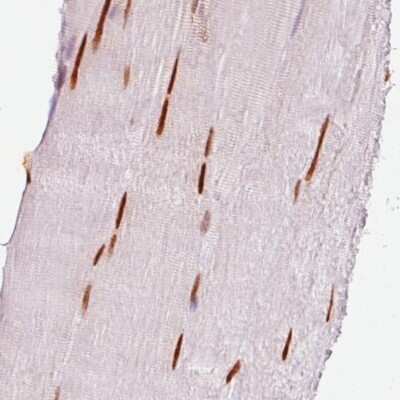 Immunohistochemistry-Paraffin: SIX1 Antibody (CL0185) [NBP2-52873]