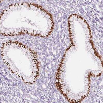 Immunohistochemistry-Paraffin: SIX1 Antibody (CL0185) [NBP2-52873]