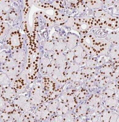 Immunohistochemistry-Paraffin: SIX1 Antibody (CL0185) [NBP2-52873]