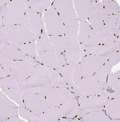 Immunohistochemistry-Paraffin: SIX1 Antibody (CL0185) [NBP2-52873]