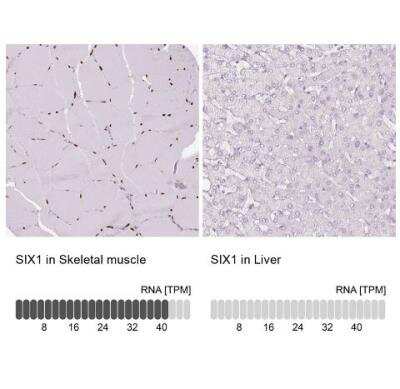 Immunohistochemistry-Paraffin: SIX1 Antibody (CL0185) [NBP2-52873]