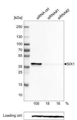 Western Blot: SIX1 Antibody (CL0185) [NBP2-52873]