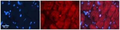 Immunohistochemistry: SIX1 Antibody [NBP1-82401]