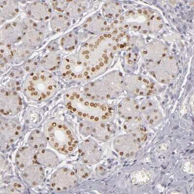 Immunohistochemistry-Paraffin: SIX1 Antibody [NBP1-84264]