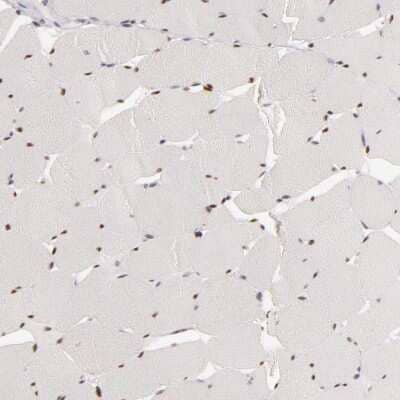 Immunohistochemistry-Paraffin: SIX1 Antibody [NBP1-84264]