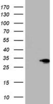 Western Blot: SIX1 Antibody (OTI1H4)Azide and BSA Free [NBP2-74209]