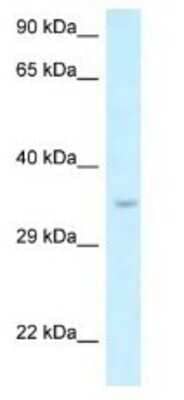 Western Blot: SIX1 Antibody [NBP1-82401]