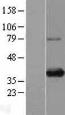 Western Blot: SIX1 Overexpression Lysate [NBL1-15982]