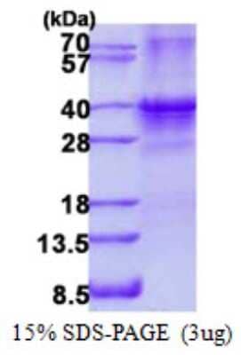 SDS-PAGE: Recombinant Human SIX1 His Protein [NBP2-22809]