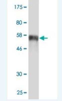 Western Blot: SIX2 Antibody (1G11) [H00010736-M02]