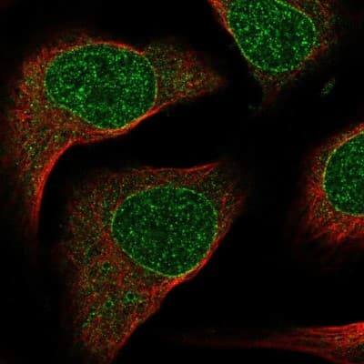 Immunocytochemistry/ Immunofluorescence: SIX2 Antibody [NBP2-54917]