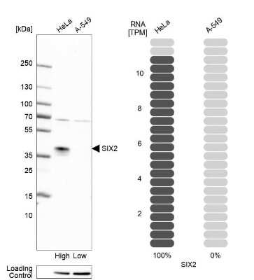 Western Blot: SIX2 Antibody [NBP2-54917]