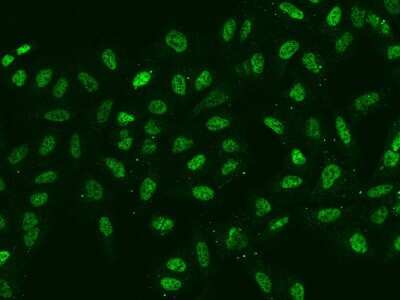 Immunocytochemistry/ Immunofluorescence: SIX4 Antibody [NBP2-98472]