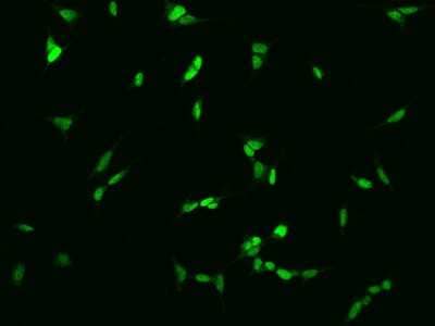 Immunocytochemistry/ Immunofluorescence: SIX6 Antibody [NBP2-98116]