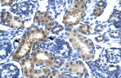 Immunohistochemistry: SIX6 Antibody [NBP2-83529]