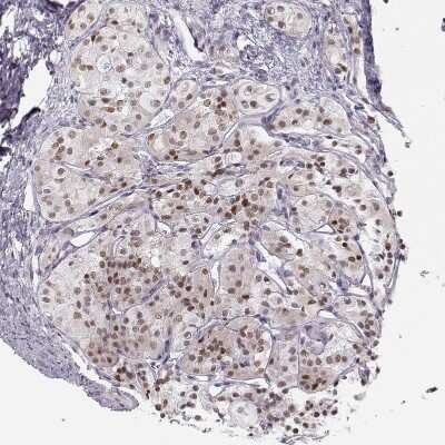 Immunohistochemistry-Paraffin: SIX6 Antibody [NBP1-82478]