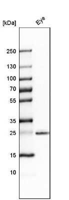 Western Blot: SIX6 Antibody [NBP1-82478]