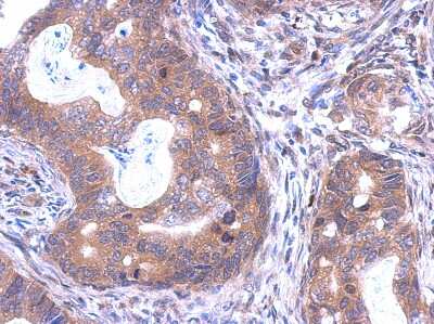 Immunohistochemistry-Paraffin: SKA1 Antibody [NBP2-20376]