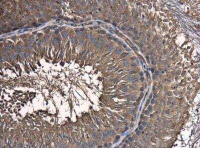 Immunohistochemistry-Paraffin: SKA1 Antibody [NBP2-20376]