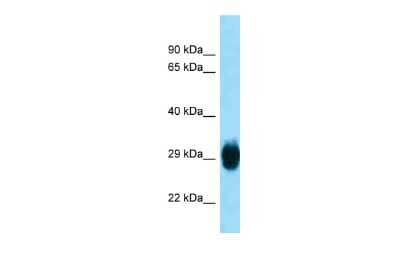 Western Blot: SKA1 Antibody [NBP2-88277]