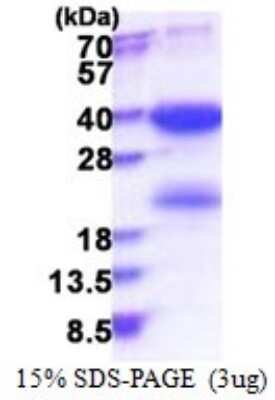 SDS-PAGE: Recombinant Human SKA1 His Protein [NBP2-51610]