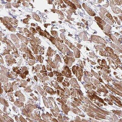 Immunohistochemistry-Paraffin: SKA2 Antibody [NBP2-32443]