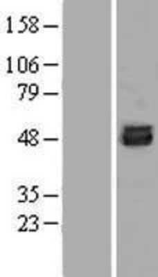 Western Blot: SKA3 Overexpression Lysate [NBP2-05508]