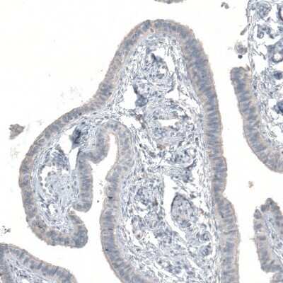 Immunohistochemistry-Paraffin: SKAP Antibody [NBP1-94007]