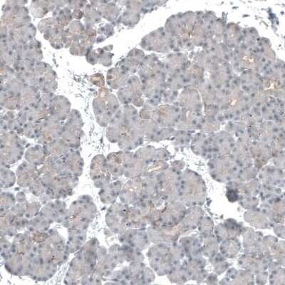 Immunohistochemistry-Paraffin: SKAP Antibody [NBP1-94007]