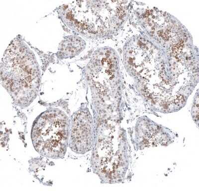 Immunohistochemistry-Paraffin: SKAP Antibody [NBP1-94007]