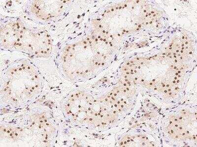 Immunohistochemistry-Paraffin: SKAP Antibody [NBP3-06036]