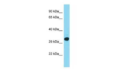 Western Blot: SKAP Antibody [NBP2-83530]