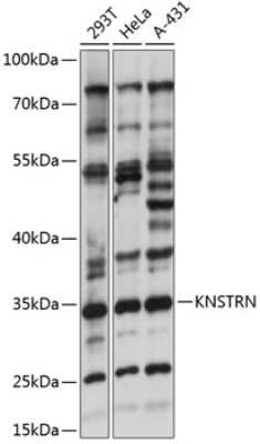 Western Blot: SKAP AntibodyAzide and BSA Free [NBP2-93210]