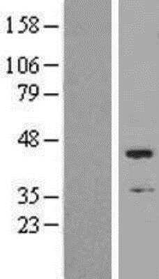 Western Blot: SKAP Overexpression Lysate [NBP2-05895]