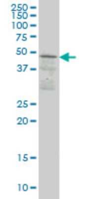 Western Blot: SKAP55 Antibody (1C11) [H00008631-M02]