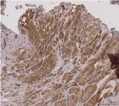 Immunohistochemistry: SKAP55 Antibody (3D3) [H00008631-M01]