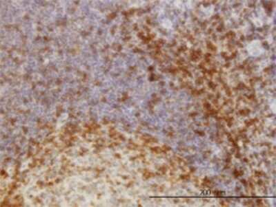 Immunohistochemistry-Paraffin: SKAP55 Antibody (3D3) [H00008631-M01]