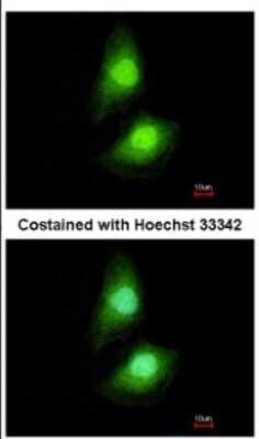 Immunocytochemistry/ Immunofluorescence: SKAP55 Antibody [NBP2-20377]