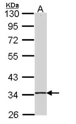 Western Blot: SKAP55 Antibody [NBP2-20377]