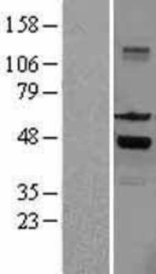 Western Blot: SKAP55 Overexpression Lysate [NBL1-15986]