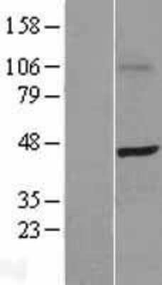 Western Blot: SKAP55 Overexpression Lysate [NBL1-15987]