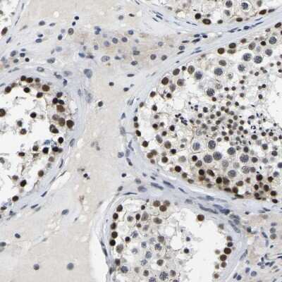 Immunohistochemistry-Paraffin: SKAR Antibody [NBP1-92392]
