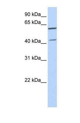 Western Blot: SKAR Antibody [NBP1-57411]