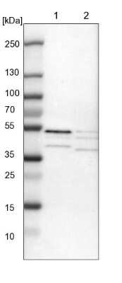 Western Blot: SKAR Antibody [NBP1-92392]